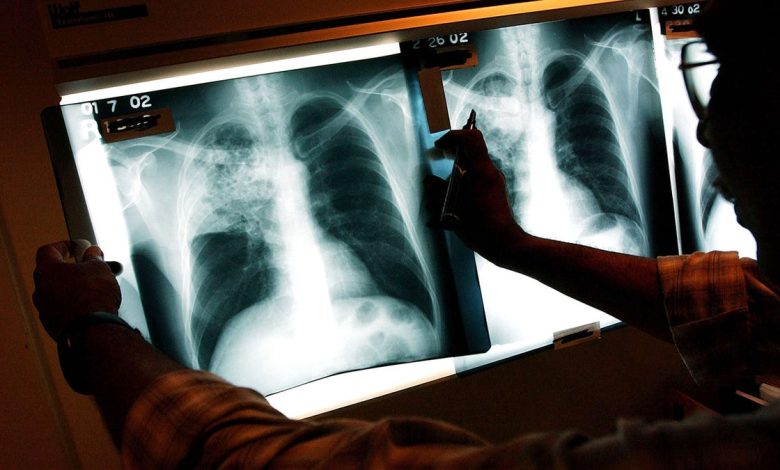 doctor examines x-ray