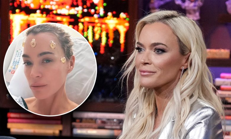 Teddi Mellencamp, 'Real Housewives' alum, updates fans after undergoing brain surgery