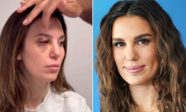 Christy Carlson Romano calls it a 'miracle' she isn't blind after bullet came within a millimeter of her eye