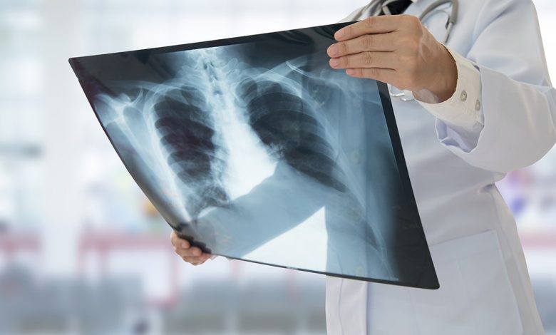 Doctor out of frame examining X-Ray