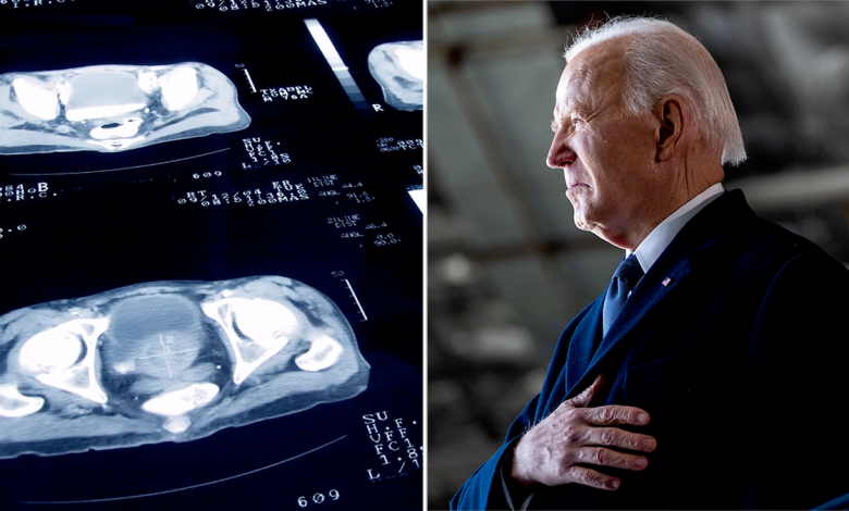 joe biden next to image of prostate cancer screening