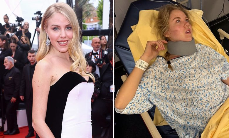 Italian princess says helmet saved her life in motorcycle accident