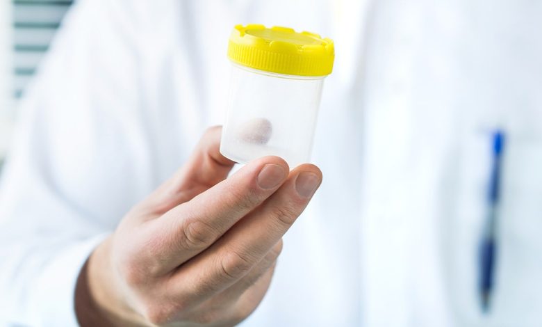 Doctor holding sample cup