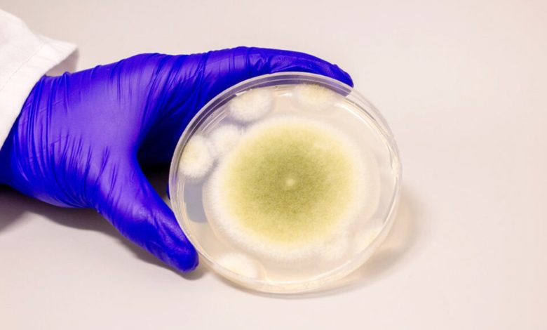 A sample of Aspergillus flavus cultured in the Gao Lab.