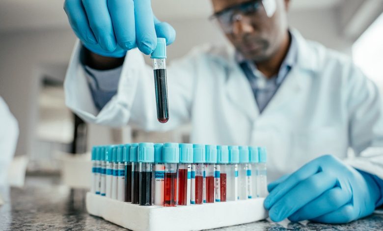 scientist analyzing blood test tubes