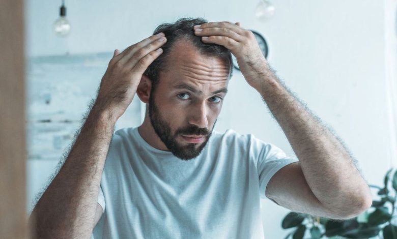 Man hair loss