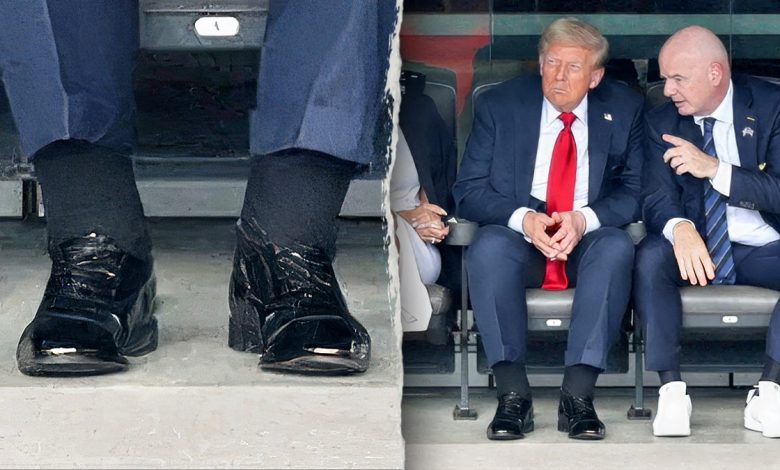 President Trump swollen ankles